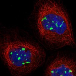 MPHOSPH10 Antibody, Novus Biologicals 25 &mu;L; Unlabeled:Antibodies, Polyclonal